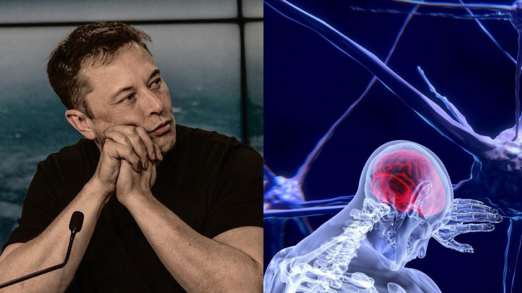 Elon Musk’s Neuralink is being outperformed by this Spanish graphene&nbsp;startup