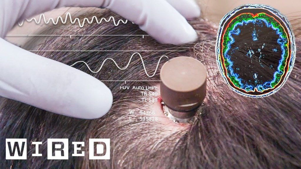 The Science Behind Elon Musk’s Neuralink Brain&nbsp;Chip