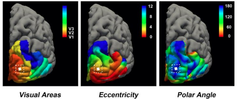 Brain Implant Offers Artificial Vision To The&nbsp;Blind