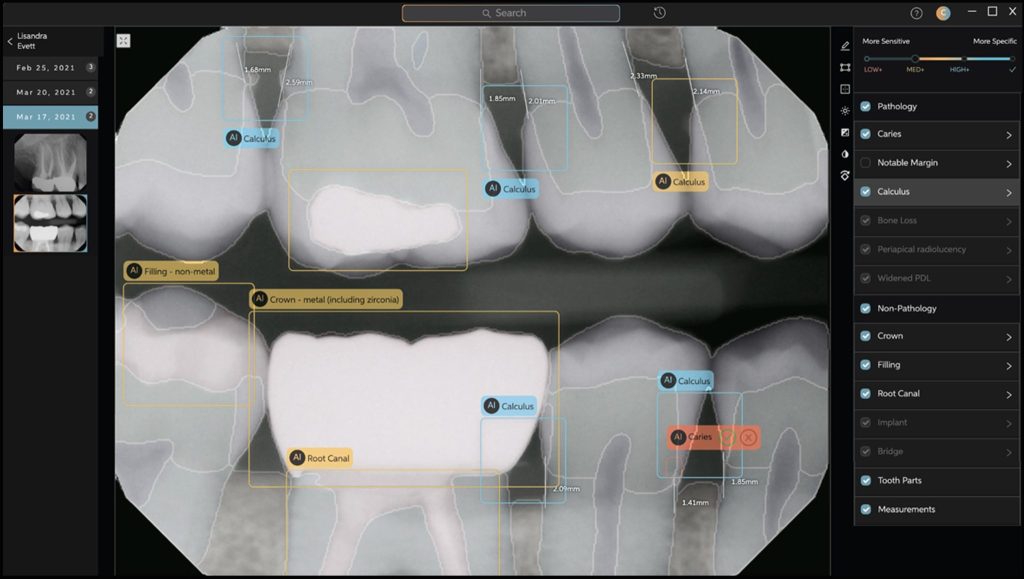 AI Takes Bite Out of Dental Slide Misses by Assisting&nbsp;Doctors