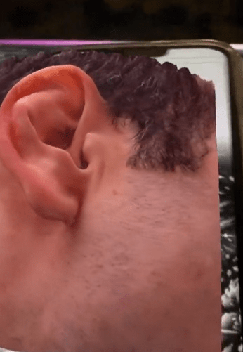 L&rsquo;immense potentiel de l&rsquo;AR et de l&rsquo;AI pour améliorer les soins aux&nbsp;patients